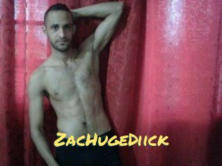 ZacHugeDiick